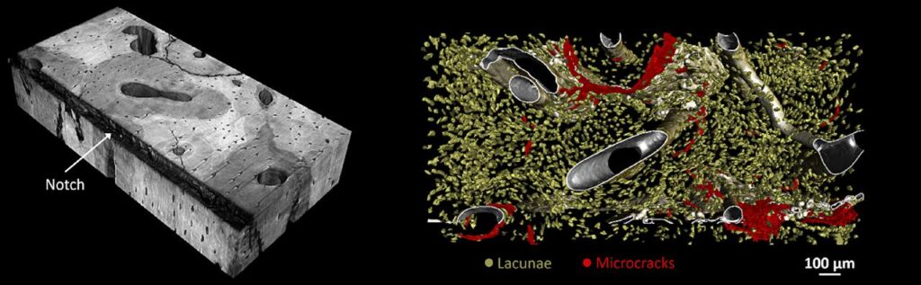 Human cortical bone crack propagation is influenced by bone microarchitecture by Rémy Gauthier