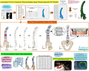 Automated Tool to Generate Thoracolumbar Spine Patient-Specific FE Modelsby Morteza Rasouligandomani